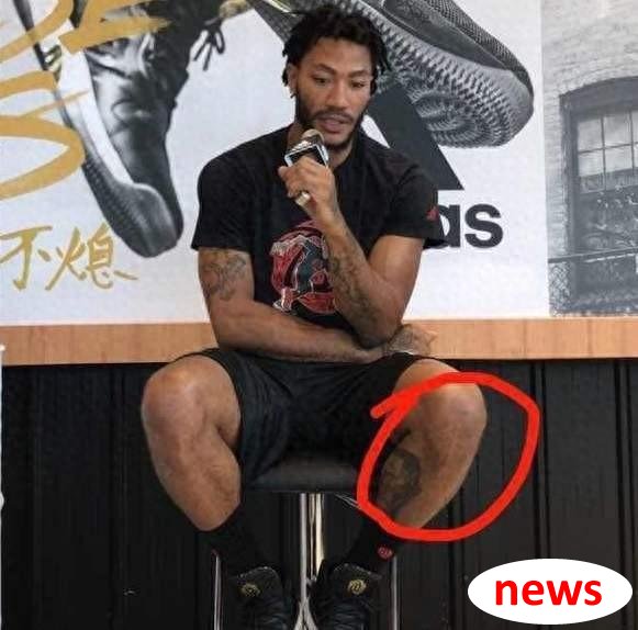 Sẹo sao NBA đáng sợ làm sao? Sẹo đầu gối của Rose là 10 cm. Tôi bị thuyết phục khi tôi thấy James